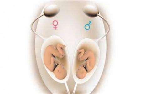 专家